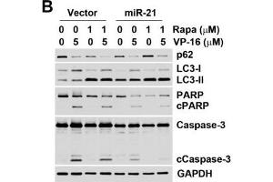 Effect of autophagy on miR-21-induced drug resistance.