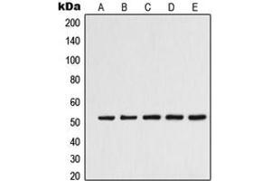 Western blot analysis of Alpha-tubulin 3C/D/E expression in K562 (A), Jurkat (B), HeLa (C), HepG2 (D), NIH3T3 (E) whole cell lysates. (alpha-Tubulin 3C/D/E (C-Term) anticorps)