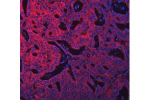 IF analysis of SWAP70 using anti-SWAP70 antibody (ABIN7600201).