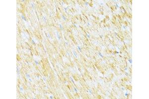 Immunohistochemistry of paraffin-embedded Rat heart using UQCR10 Polyclonal Antibody at dilution of 1:100 (40x lens). (UQCR10 anticorps)