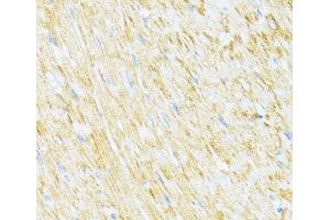 Immunohistochemistry of paraffin-embedded Rat heart using UQCR10 Polyclonal Antibody at dilution of 1:100 (40x lens).