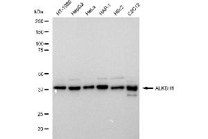 Western blotting analysis using ALKBH1 antibody (ABIN7797579).