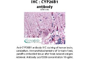 Image no. 2 for anti-Cytochrome P450, Family 26, Subfamily B, Polypeptide 1 (CYP26B1) (AA 160-396) antibody (ABIN1733454) (CYP26B1 anticorps  (AA 160-396))