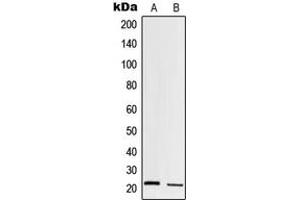 Western blot analysis of Trypsin 1 expression in HT1080 (A), human pancreas (B) whole cell lysates. (PRSS1 anticorps  (Center))