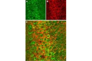 Expression of NMDA receptor 2B in rat hippocampus - Immunohistochemical staining of rat hippocampal CA1 frozen sections stained with Anti-NMDAR2B (GluN2B) (extracellular) Antibody (ABIN7043230, ABIN7044326 and ABIN7044327), (1:100).