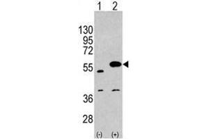 Image no. 1 for anti-Sprouty-Related, EVH1 Domain Containing 1 (SPRED1) (C-Term) antibody (ABIN356945) (SPRED1 anticorps  (C-Term))