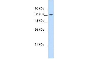 WB Suggested Anti-KIAA0319 Antibody Titration:  1. (KIAA0319 anticorps  (N-Term))