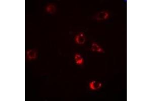 Immunofluorescent analysis of HSP47 staining in Hela cells. (SERPINH1 anticorps)