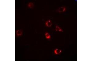 Immunofluorescent analysis of HSP47 staining in Hela cells. (SERPINH1 anticorps)