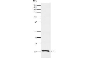 Western blot analysis of Estrogen Inducible Protein pS2 expression in MCF-7 cell lysate.