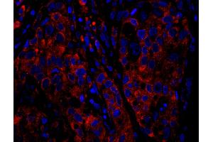 Immunofluorescence (IF) image for anti-Ribosomal Protein S6 (RPS6) (C-Term) antibody (ABIN7449016) (RPS6 anticorps  (C-Term))