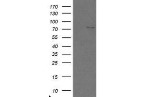 Image no. 1 for anti-SKI-Like Oncogene (SKIL) (AA 307-684) antibody (ABIN1491385) (SKIL anticorps  (AA 307-684))