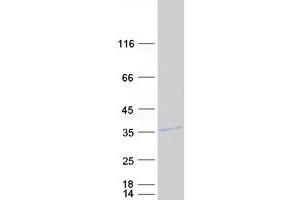 Validation with Western Blot