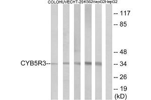 Western blot analysis of extracts from COLO cells, HUVEC cells, HT-29 cells, K562 cells and HepG2 cells, using CYB5R3 antibody. (CYB5R3 anticorps  (Internal Region))