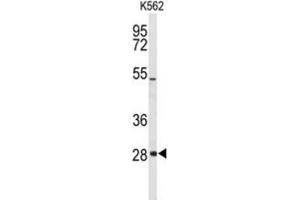 Western Blotting (WB) image for anti-Claudin 18 (CLDN18) (AA 231-259) antibody (ABIN3004093)