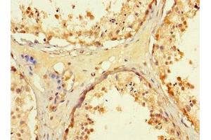 Immunohistochemistry of paraffin-embedded human testis tissue using ABIN7171480 at dilution of 1:100 (WRB anticorps  (AA 38-99))