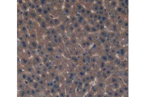 Used in DAB staining on fromalin fixed paraffin- embedded Kidney tissue (EIF2D anticorps  (AA 360-570))