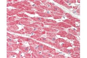 Human Heart: Formalin-Fixed, Paraffin-Embedded (FFPE).