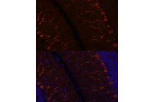 Immunofluorescence analysis of rat brain using K antibody (ABIN7268068) at dilution of 1:100.