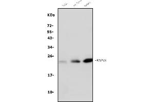 Western blot analysis of RBPMS using anti-RBPMS antibody (ABIN7602120).