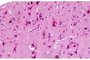 Human Brain: Formalin-Fixed, Paraffin-Embedded (FFPE) (CNR2 anticorps  (AA 191-240))