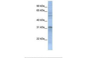 Image no. 1 for anti-Mitochondrial Carrier 2 (MTCH2) (N-Term) antibody (ABIN6739044) (MTCH2 anticorps  (N-Term))