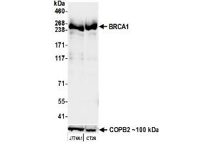 Western Blotting (WB) image for anti-Breast Cancer 1 (BRCA1) (AA 525-575) antibody (ABIN7795735)
