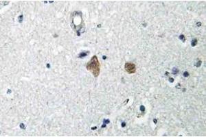 Immunohistochemistry (IHC) analyzes of mTOR antibody in paraffin-embedded human brain tissue. (MTOR anticorps  (pSer2448))