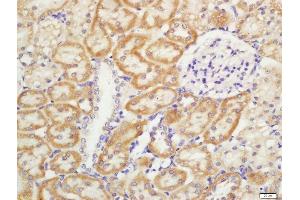 Formalin-fixed and paraffin embedded rat kidney labeled with Rabbit Anti-CD11b/c Polyclonal Antibody, Unconjugated  at 1:200 followed by conjugation to the secondary antibody and DAB staining (CD11b anticorps  (AA 520-570))