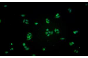 Detection of GLa in Human MCF7 cell using Monoclonal Antibody to Galactosidase Alpha (GLa)