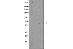 Western blot analysis of extracts of Y79, using ADIPOR1 antibody. (Adiponectin Receptor 1 anticorps  (C-Term))