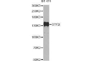 Western blot analysis of extracts of BT-474 cells, using GTF2I antibody (ABIN5995399) at 1/500 dilution. (GTF2I anticorps)