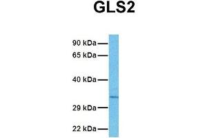 Host:  Rabbit  Target Name:  GLS2  Sample Tissue:  Human NCI-H226  Antibody Dilution:  1.