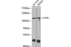 Western blot analysis of extracts of various cell lines, using LZTR1 antibody (ABIN6130529, ABIN6143415, ABIN6143416 and ABIN6223199) at 1:1000 dilution.