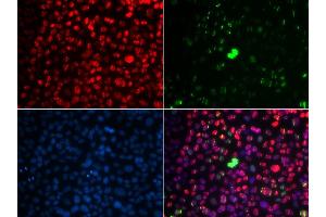 Immunofluorescence analysis of U2OS cells using Phospho-ATM-S1981 antibody (ABIN5969871). (ATM anticorps  (pSer1981))