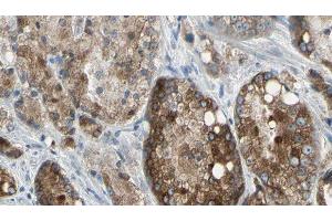 ABIN6276838 at 1/100 staining Human prostate tissue by IHC-P. (TLR5 anticorps  (C-Term))