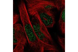 Immunofluorescent staining of RH30 cells with SIX1 monoclonal antibody, clone CL0185  (Green) shows spotty nuclear. (SIX Homeobox 1 anticorps)