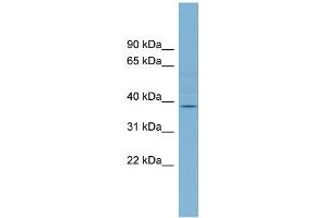 WB Suggested Anti-B3GALNT1 Antibody Titration:  0. (B3GALNT1 anticorps  (Middle Region))