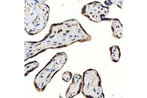 IHC analysis of SNRNP200 using anti-SNRNP200 antibody (ABIN7602032).