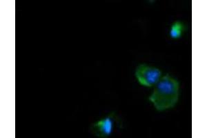 Image no. 8 for anti-NADH Dehydrogenase (Ubiquinone) 1 beta Subcomplex, 10, 22kDa (NDUFB10) antibody (ABIN1499669)