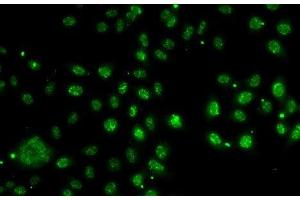 Immunofluorescence analysis of A-549 cells using LDLRAP1 Polyclonal Antibody (LDLRAP1 anticorps)