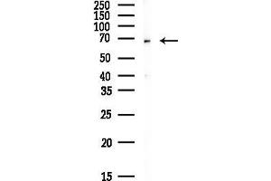 Western blot analysis of lysates from Mouse brain, using MUNC-18a Antibody at 1/1000 dilution.