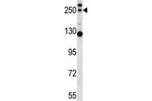 C4B antibody western blot analysis in mouse lung tissue lysate