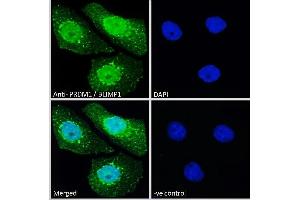 ABIN570911 Immunofluorescence analysis of paraformaldehyde fixed A431 cells, permeabilized with 0.