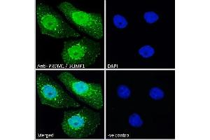 ABIN570911 Immunofluorescence analysis of paraformaldehyde fixed A431 cells, permeabilized with 0. (PRDM1 anticorps  (C-Term))