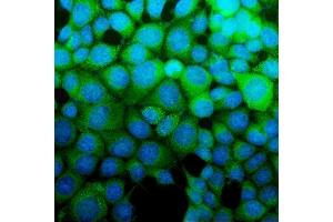 IF analysis of ASS1 using anti-ASS1 antibody (ABIN7601191).