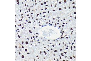 Immunohistochemistry of paraffin-embedded mouse liver using Phospho-Rb-S780 antibody (ABIN7269936) at dilution of 1:100 (40x lens).