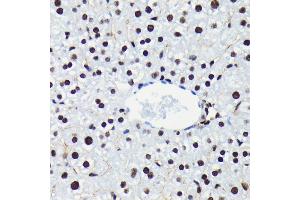 Immunohistochemistry of paraffin-embedded mouse liver using Phospho-Rb-S780 antibody (ABIN7269936) at dilution of 1:100 (40x lens). (Retinoblastoma 1 anticorps  (pSer780))