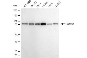 Western blotting analysis using SUZ12 antibody (ABIN7800473).