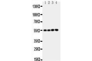 Anti-NRF1 antibody, Western blotting Lane 1: Rat Brain Tissue Lysate Lane 2: Rat Kidney Tissue Lysate Lane 3: MCF-7 Cell Lysate Lane 4: A549 Cell Lysate (NRF1 anticorps  (Middle Region))